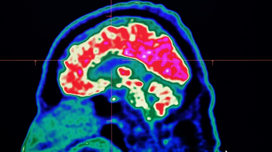 "Décoder" les pensées par l'imagerie cérébrale et l'intelligence artificielle