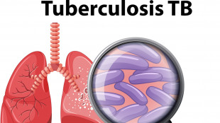 Tbc 'principale minaccia infettiva',8,2 milioni di casi nel 2023