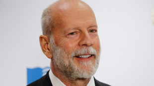 Bruce Willis es diagnosticado con demencia (familia)